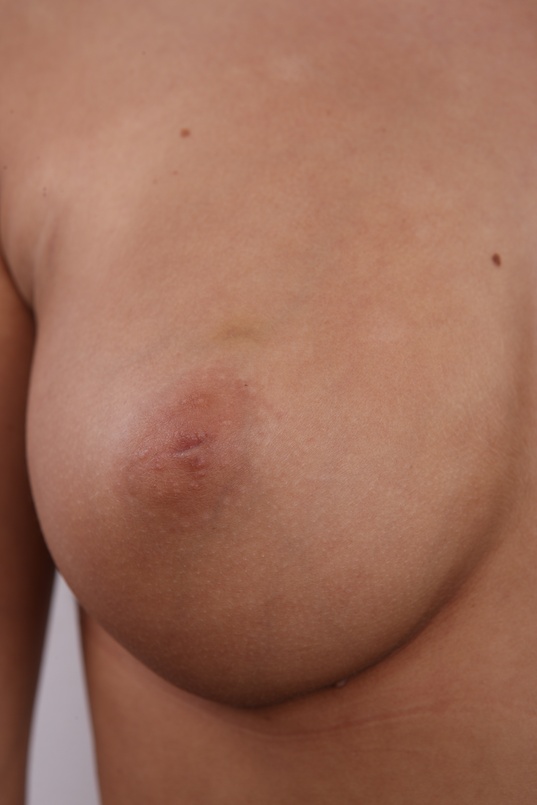 13. Download full pics of Silvie (19) from czechcasting.com