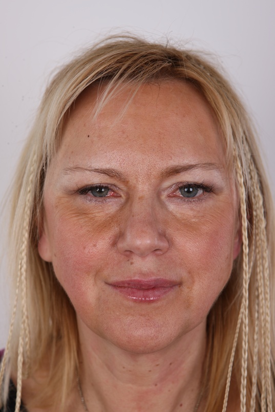 1. Download full pics of Jaroslava (52) from czechcasting.com