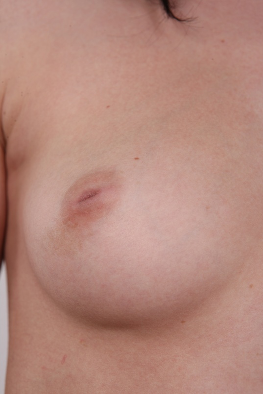 9. Download full pics of Mila (19) from czechcasting.com