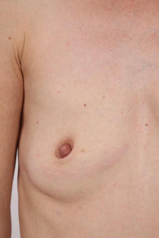 13. Download full pics of Laura (41) from czechcasting.com