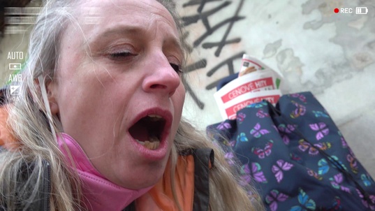 1. Download full pics of 10k USD Vaginal Prolapse from extremestreets.com